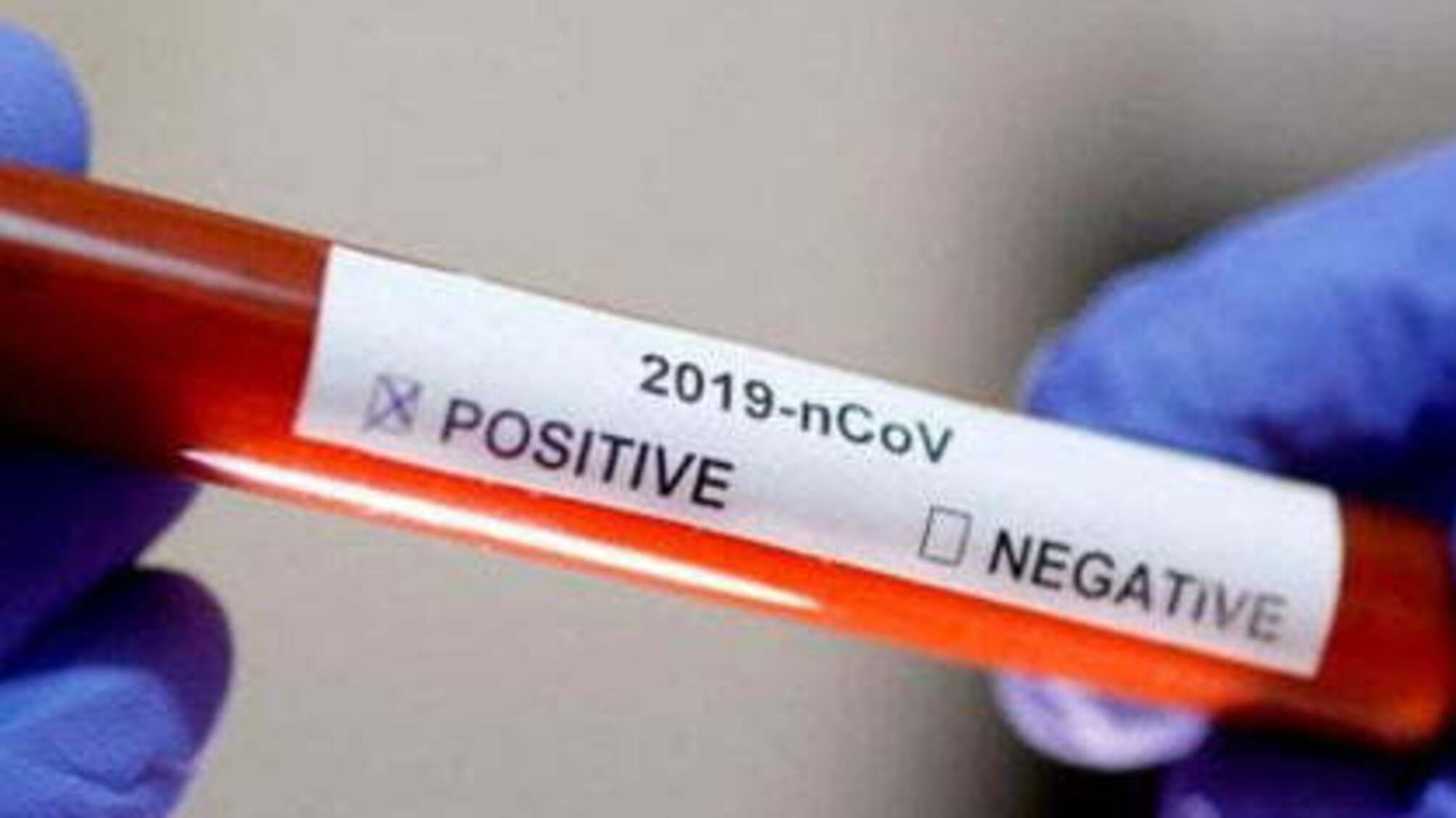 У співробітника ЧАЕС виявили коронавірус