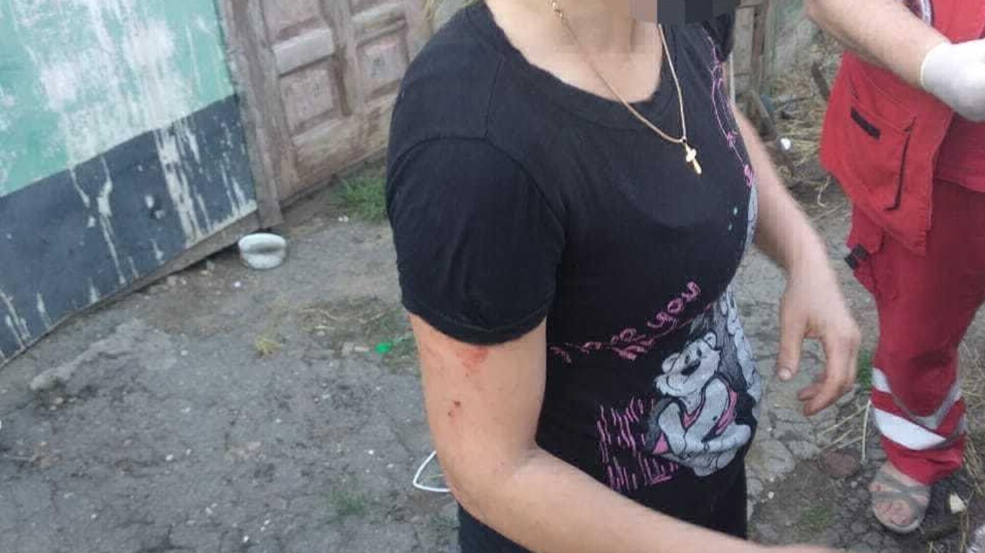 Гралися з гранатою: через вибух на Одещині постраждало 5 людей (відео)