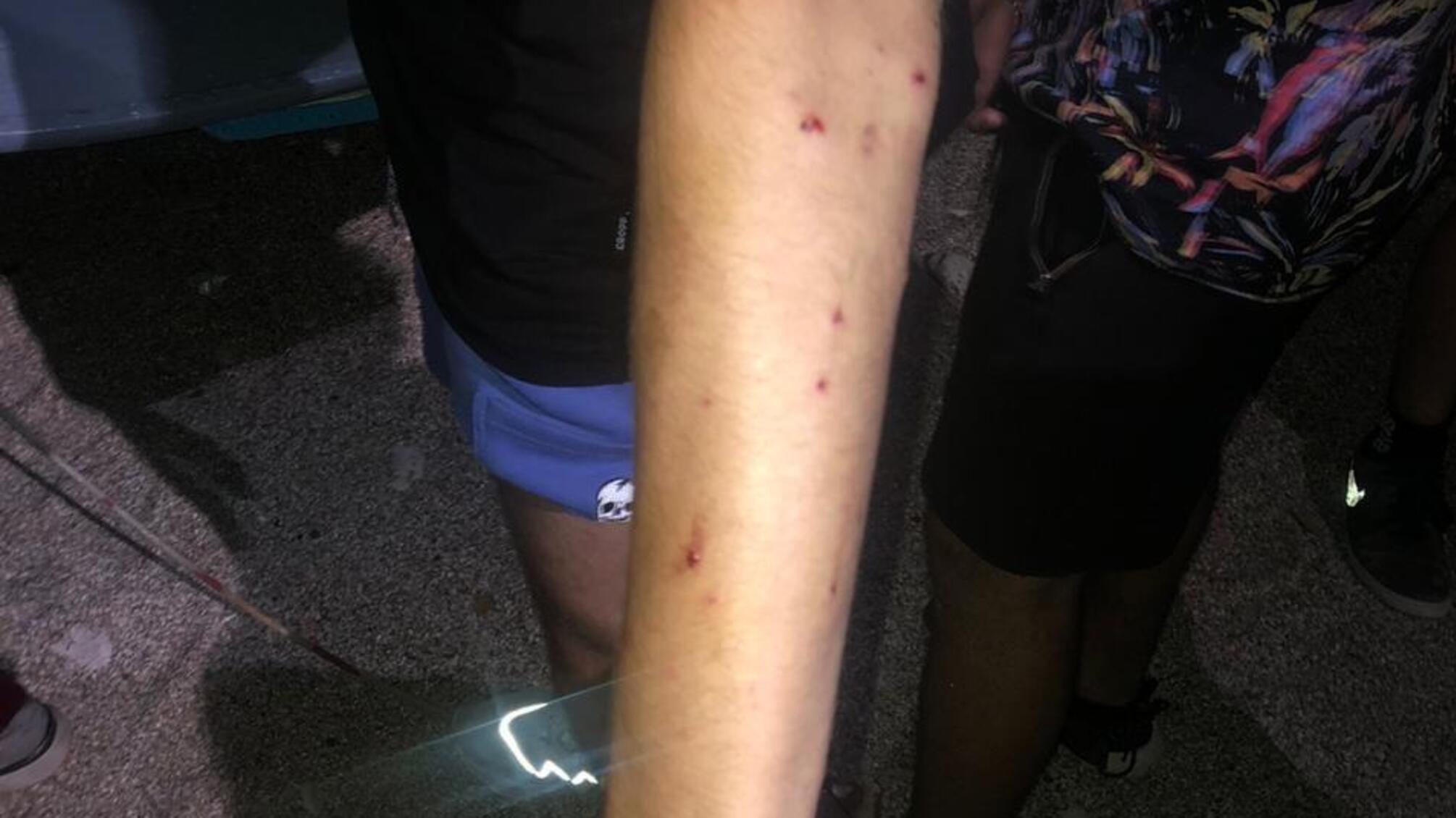 Поліцейські оперативно затримали чоловіка, який влаштував стрілянину у бік відпочиваючих на одеському узбережжі