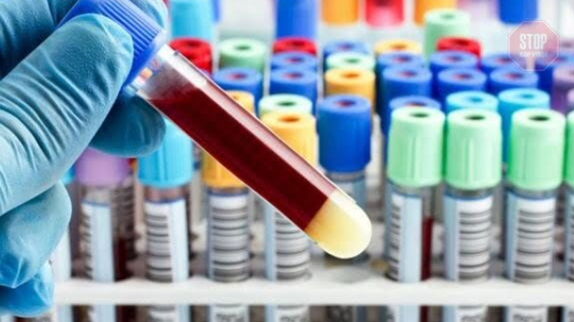 У Вінниці стався спалах COVID-19 серед працівників РАГСу