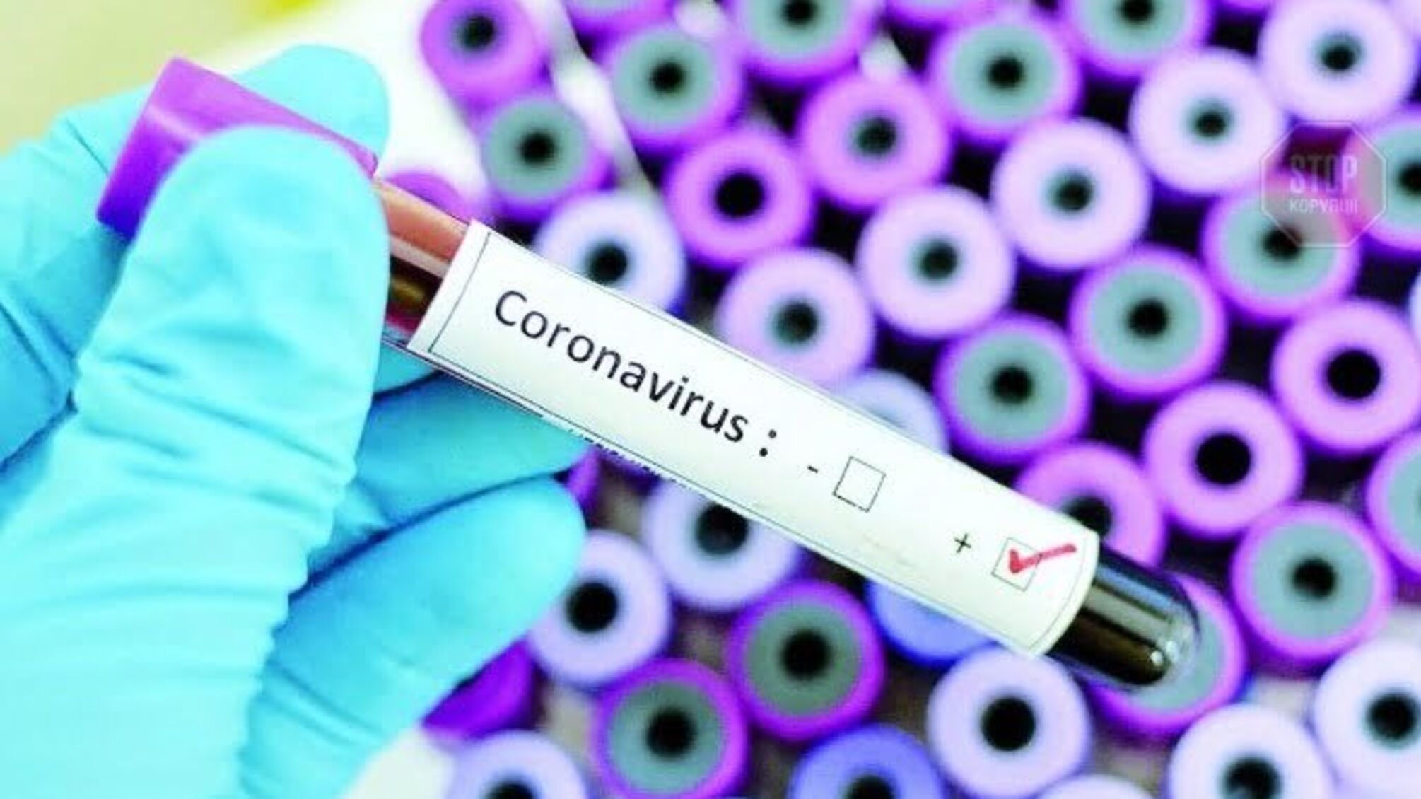 У ВООЗ розповіли про рекордну кількість хворих від коронавірусу