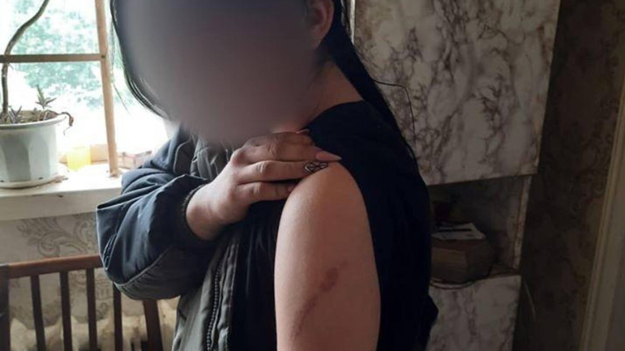 Поліція відкрила кримінальне провадження щодо матері, яка вдягла ланцюг на ноги своєї дочки