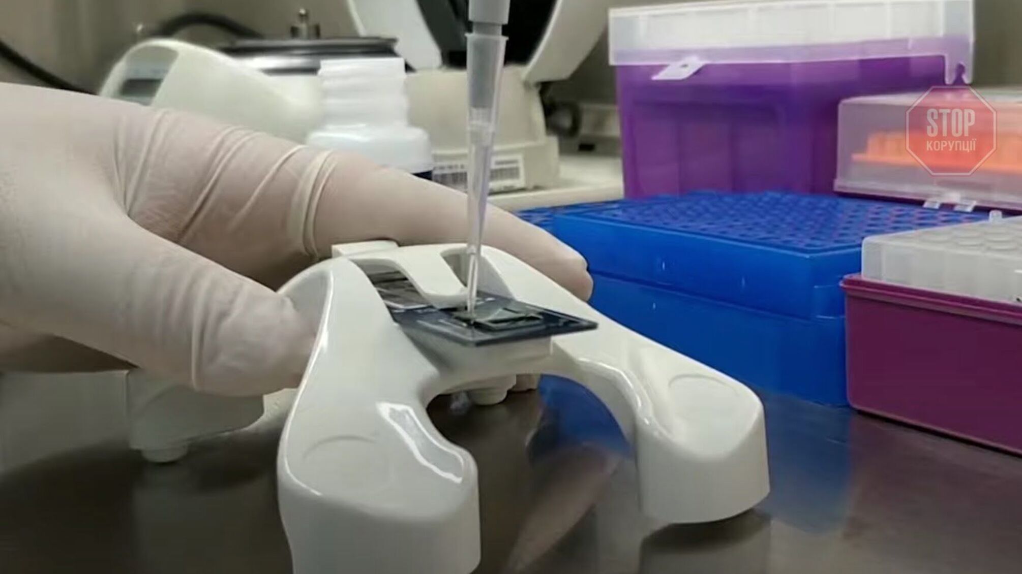 На пацієнтах з коронавірусом зекономлять: робитимуть один ПЛР-тест замість двох