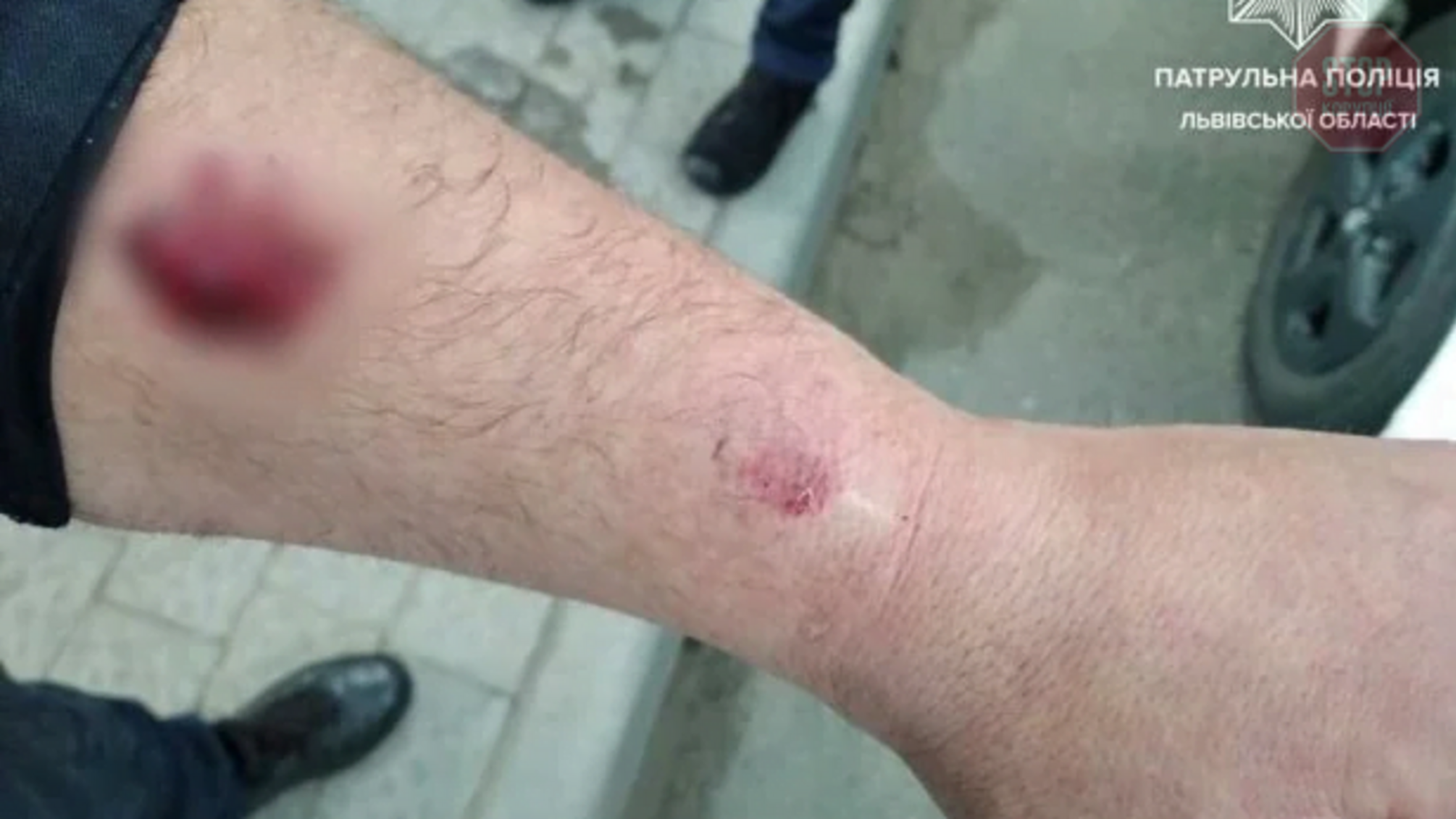 У Львові водій покусав співробітника поліції