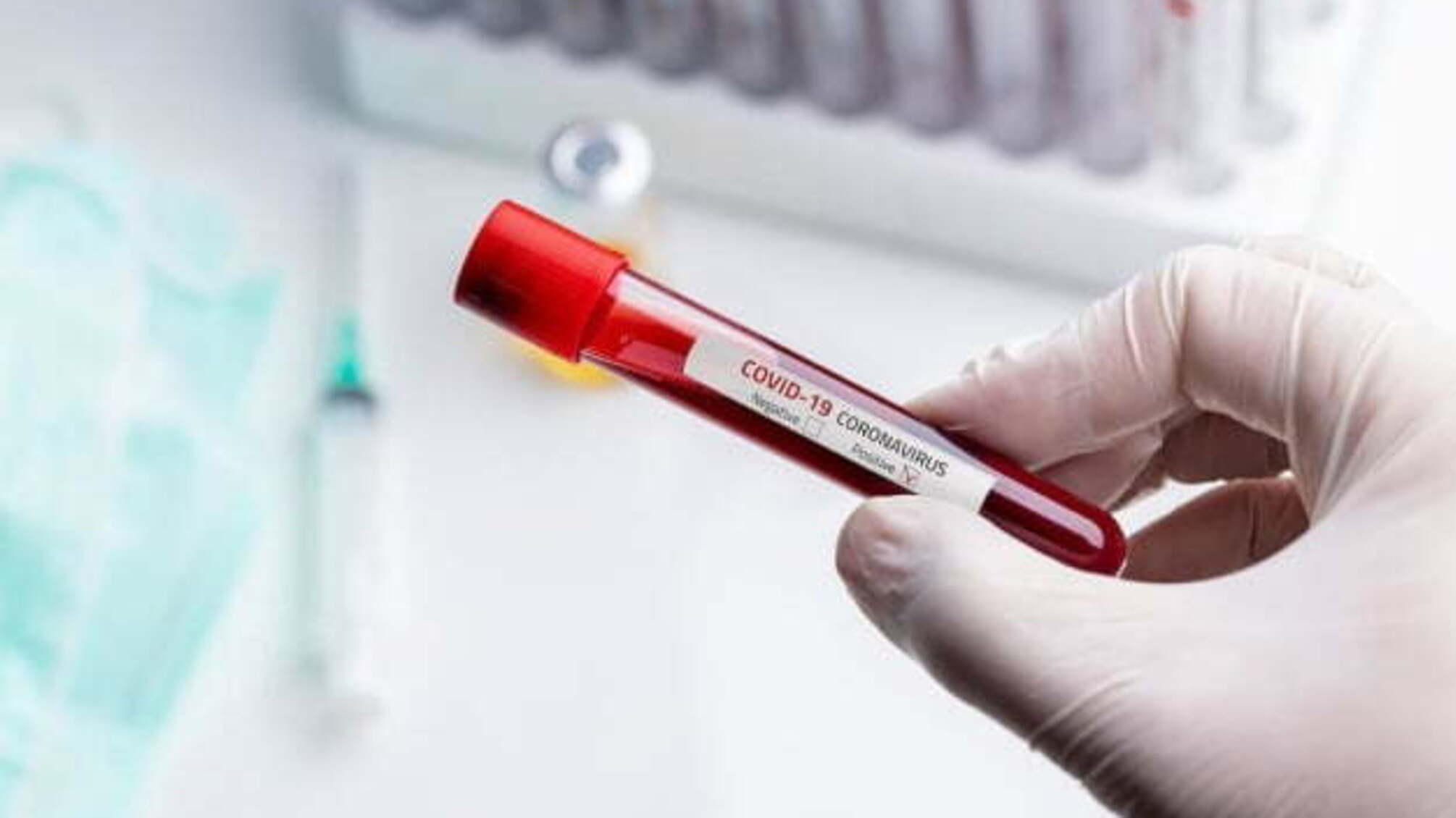 Кількість випадків коронавірусу у світі перевищила 16 мільйонів