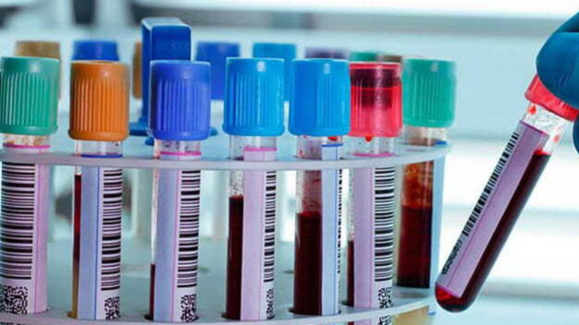 В окупованому Криму нарахували 21 новий випадок COVID-19