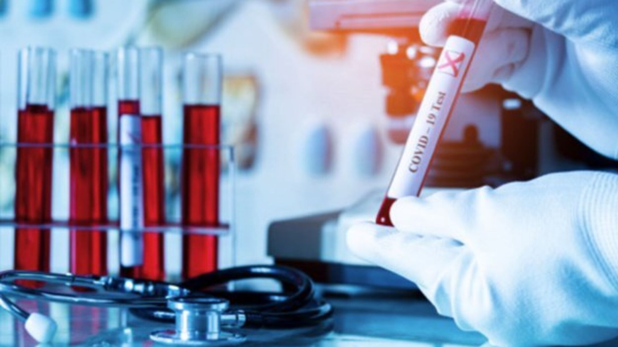 Кількість випадків COVID-19 у світі перевищила 17 мільйонів