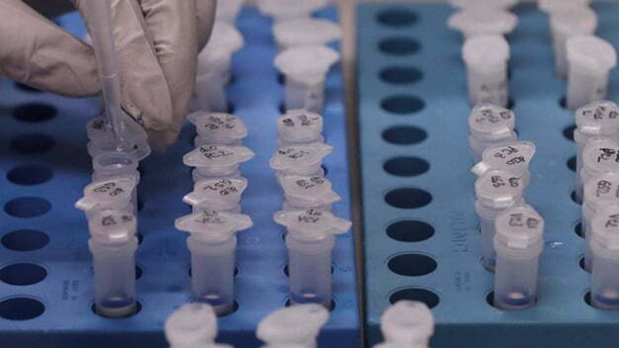 На Чернігівщині кількість хворих на COVID-19 сягнула 1025