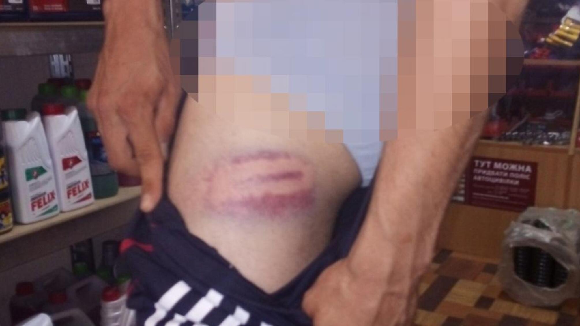 Поліцейський постане перед судом за побиття та затримання громадян після зупинки автомобіля (ВІДЕО)