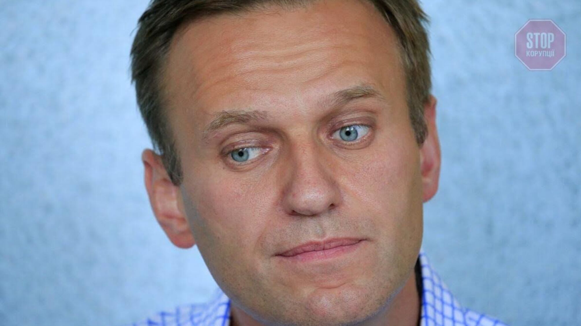 Навального не отруїли, — лікарі повідомили про діагноз опозиціонера