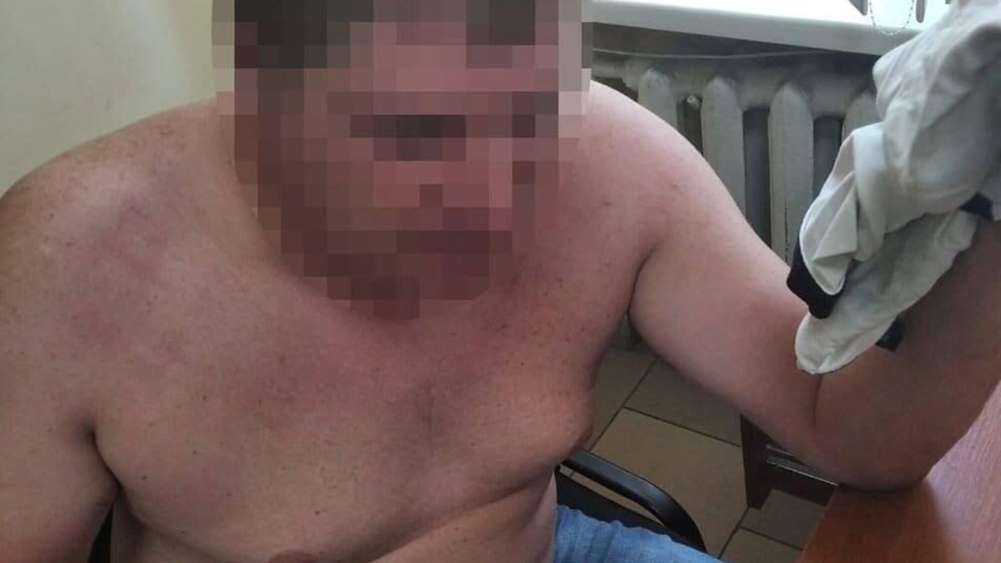 Житель Одещини покусав та побив поліцейських