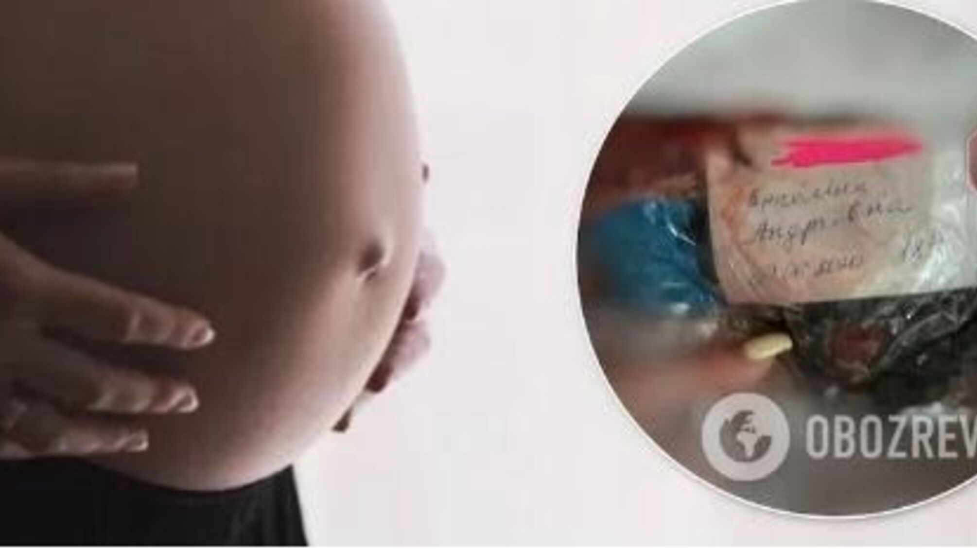 На Дніпропетровщині породіллі віддали тіло дитини у сміттєвому пакеті