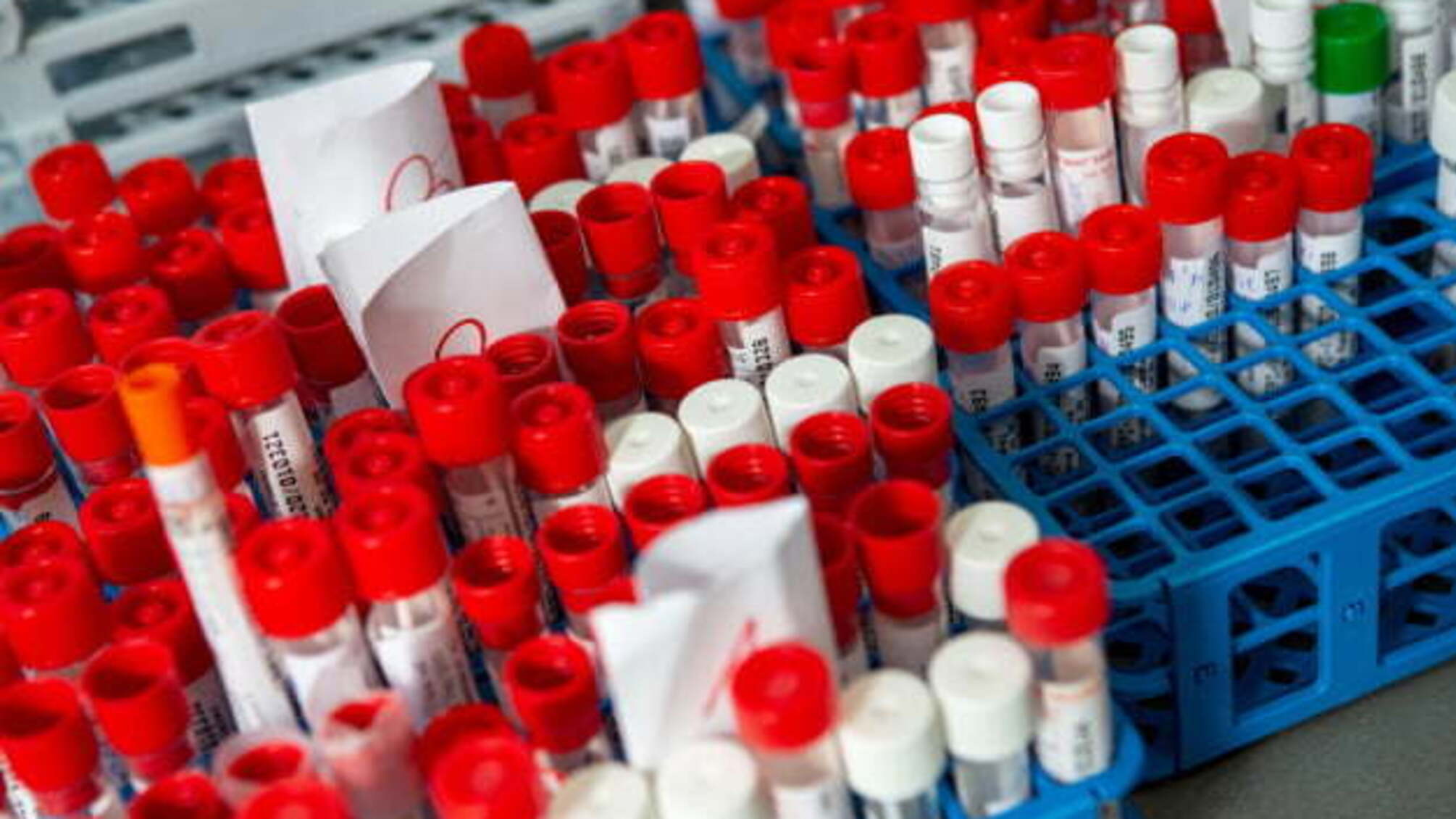 У світі кількість випадків коронавірусу наближається до 26 мільйонів