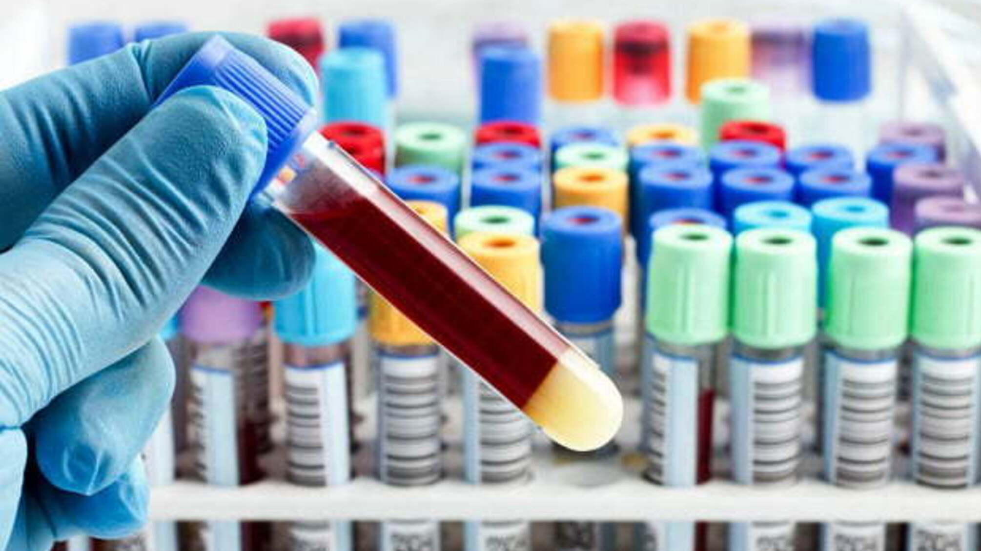 Канада перевірила на коронавірус 15% своїх жителів