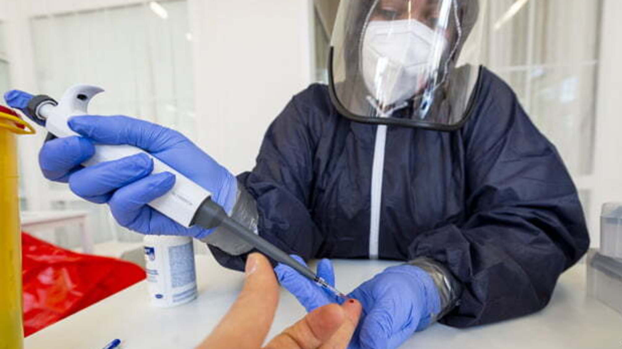 Степанов озвучив «приємний рекорд» - за добу понад дві тисячі пацієнтів одужали від COVID-19