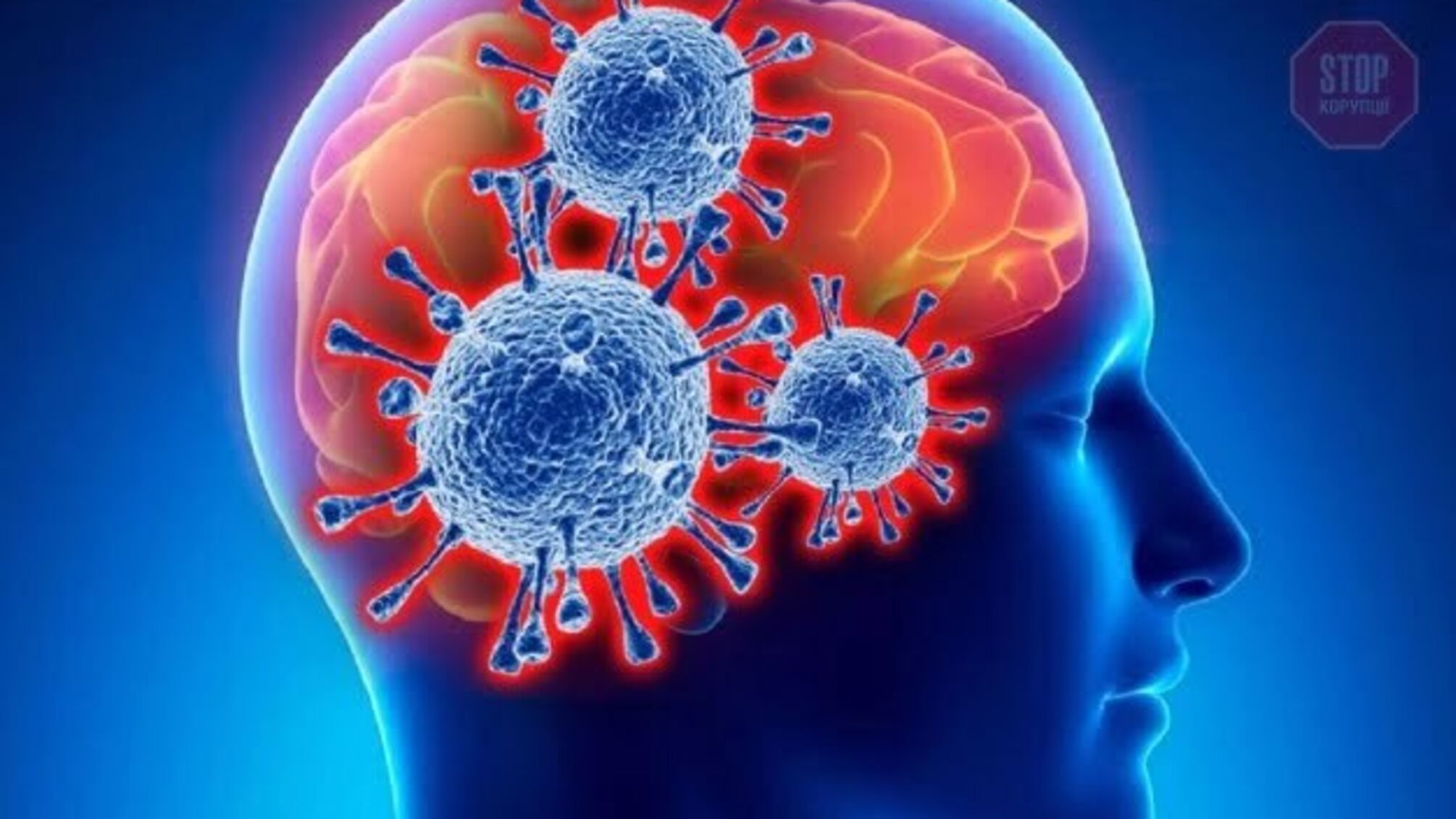 COVID-19 може нести найсерйознішу загрозу для людського мозку