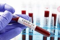 НАН України спрогнозувала розвиток пандемії COVID-19 в країні