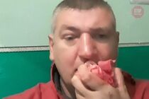 Струс мозку і перелом носа: в Олевську люди Пашинського напали на кандидата в депутати