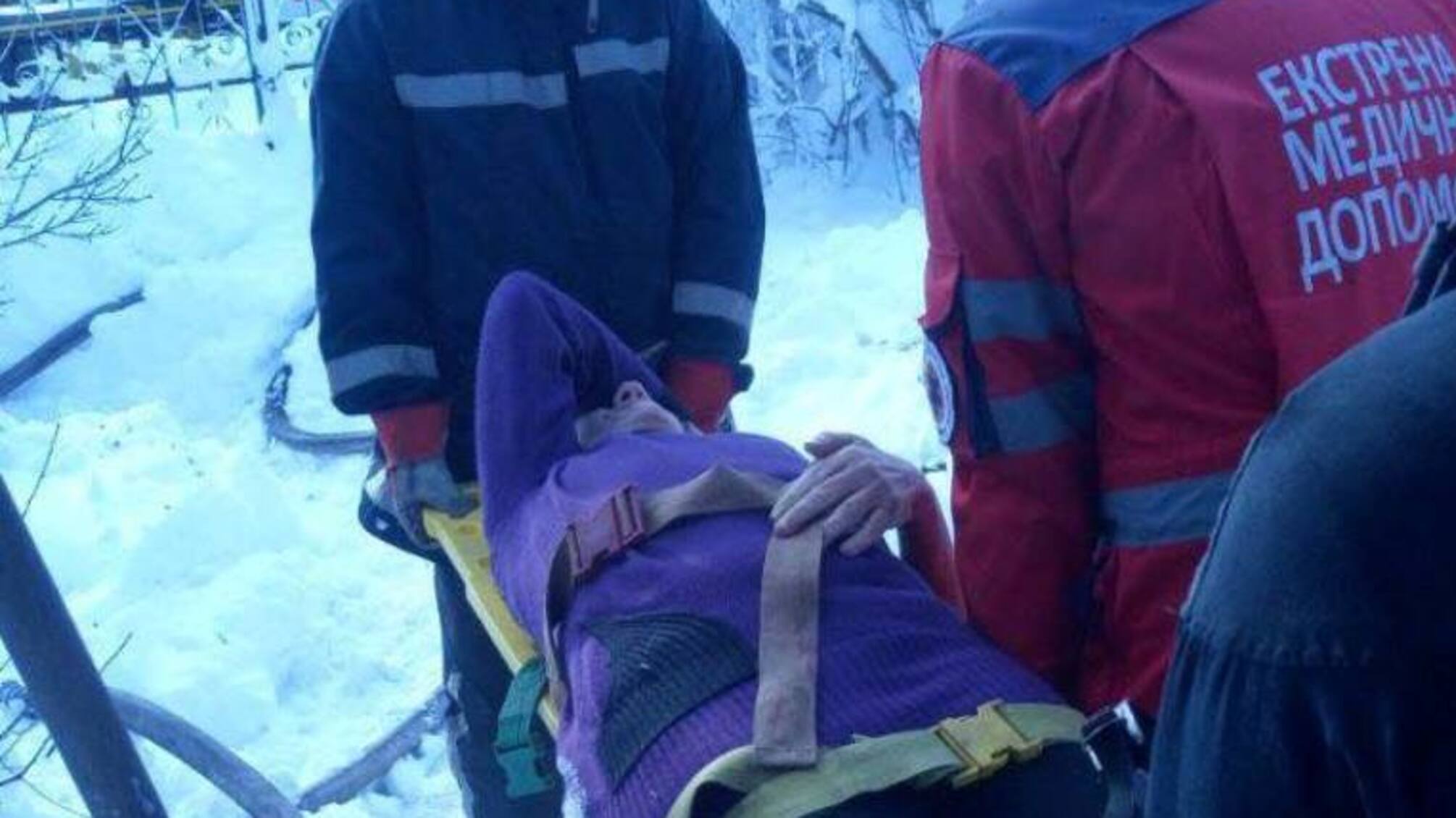 Одеська область: на пожежі виявлено загиблу господарку будинку та врятовано жінку