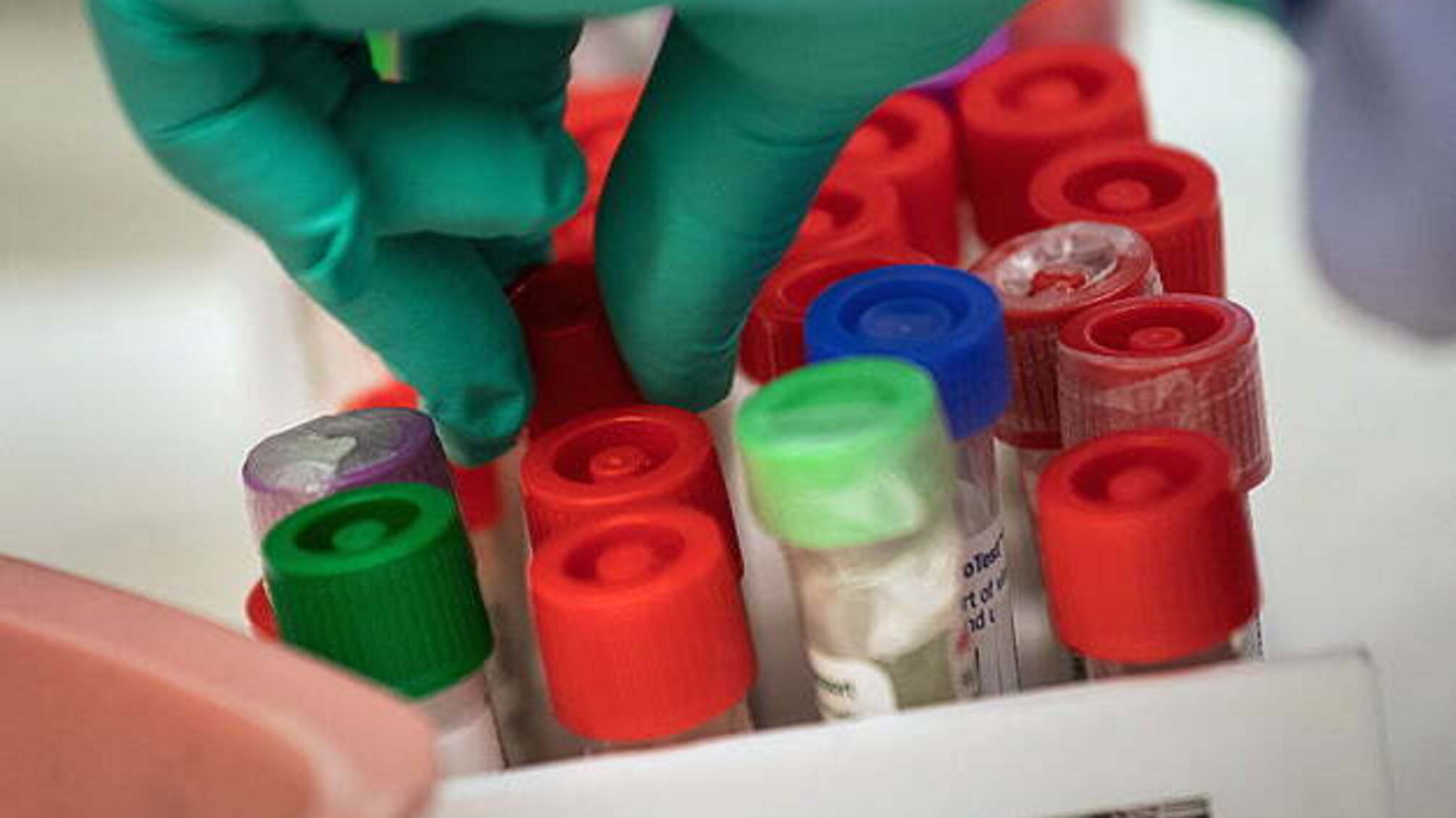 У Києві за добу виявили 344 випадки коронавірусу, 15 хворих померли