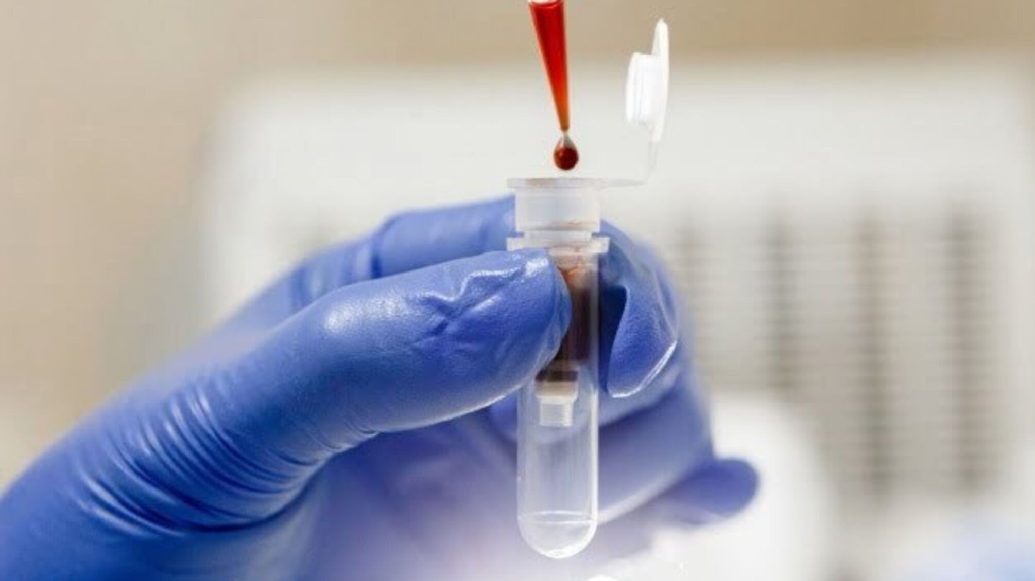 В Україні за добу -  2 779 випадків коронавірусу