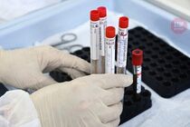 Україна отримала понад мільйон закуплених ПЛР-тестів на коронавірус