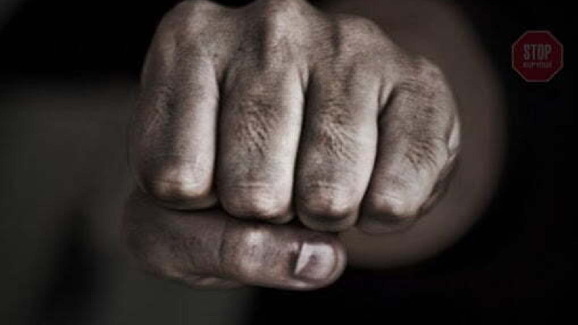 В Одеській області помер військовий, якого побили товариші по службі