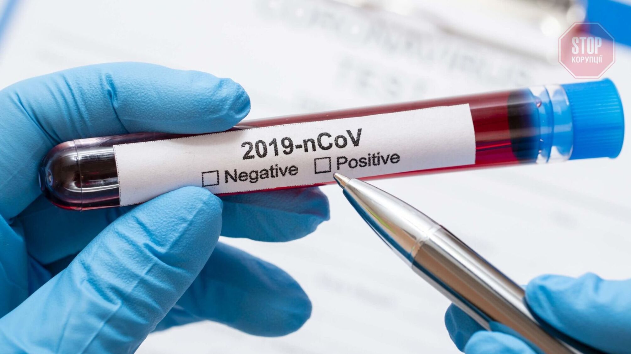 Ковид в Украине: почти 10 тысяч новых случаев и 317 смертей