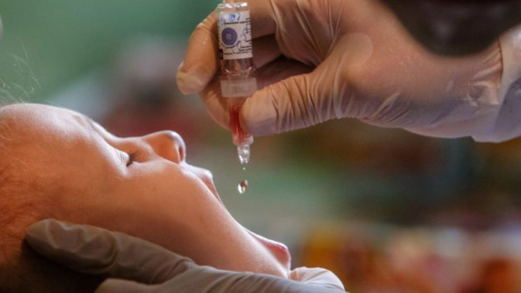 На Рівненщині запустили нульовий раунд імунізації дітей від поліомієліту - Кузін