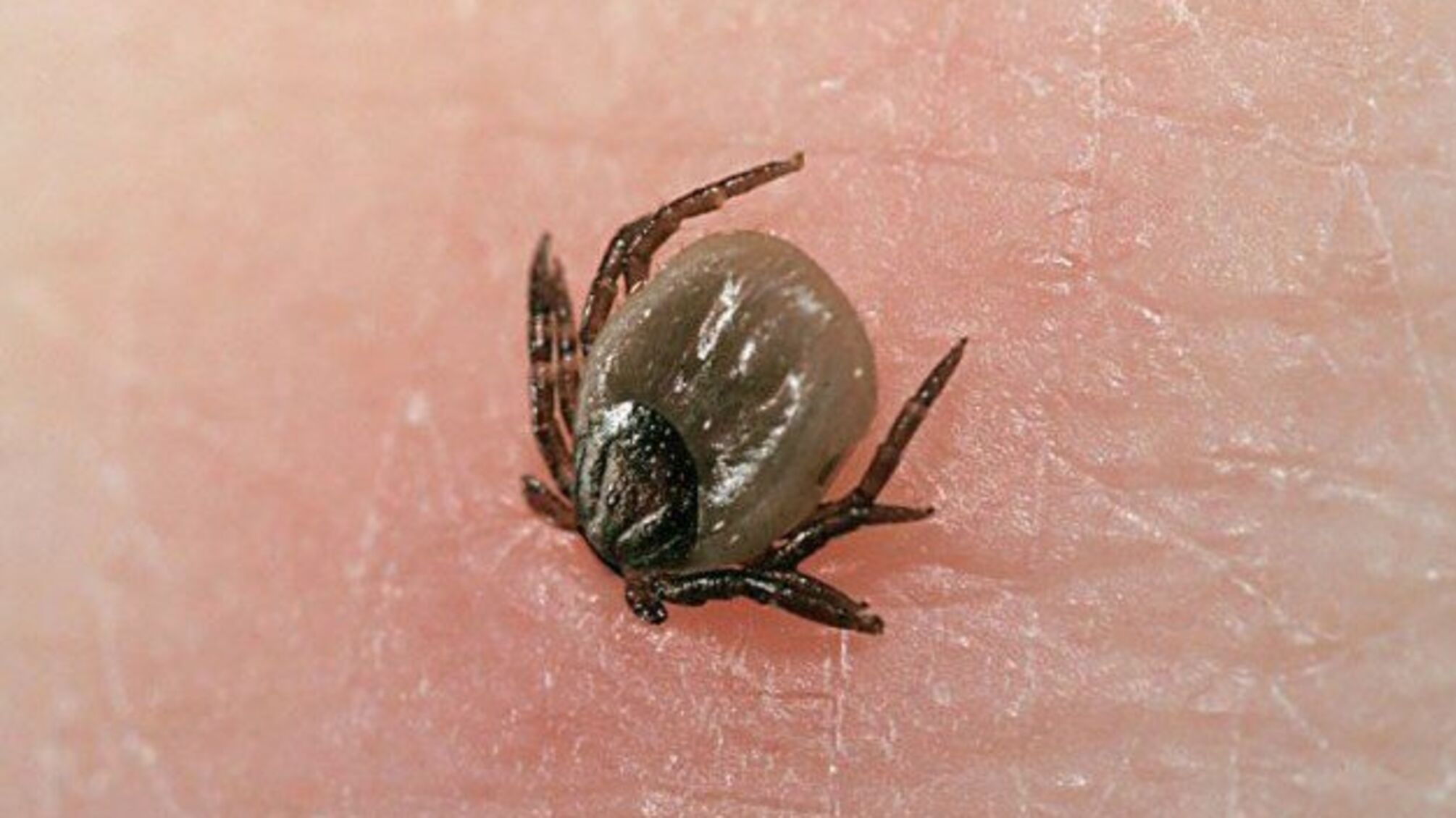 В Японії виявили вірус, що передається від укусу кліщів