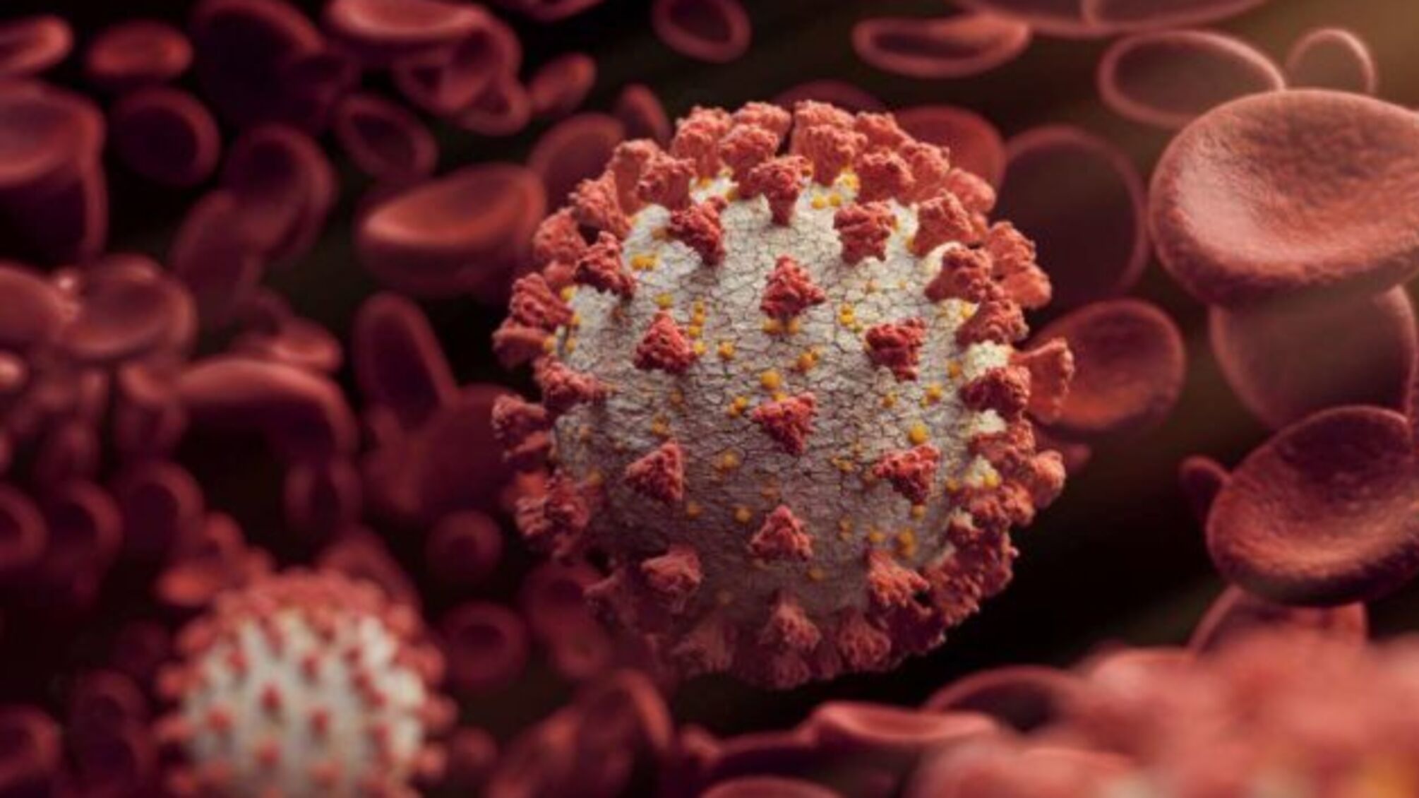 Інсульти та втрата пам’яті: COVID-19 може пошкодити судини мозку