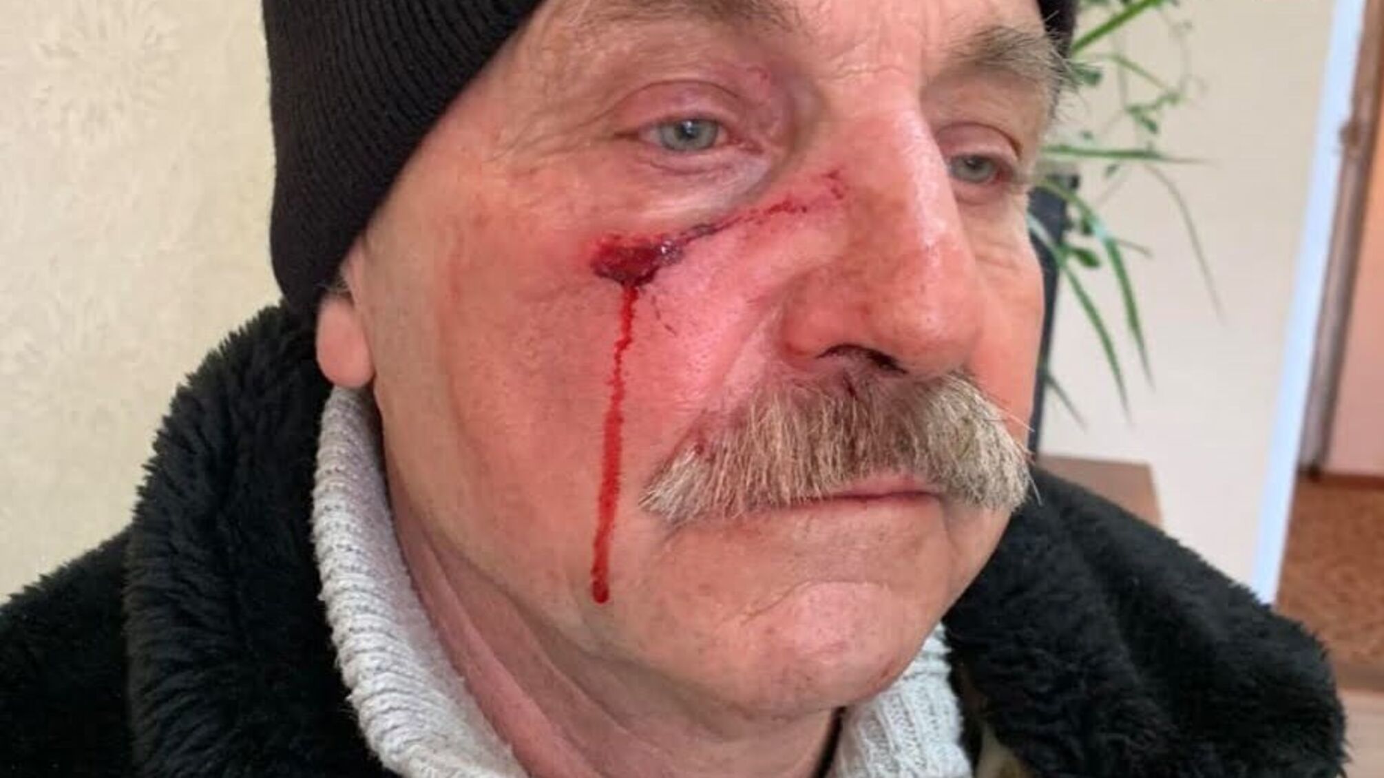 На Кіровоградщині депутат розбив голову громадському діячу: чоловік у лікарні (відео)