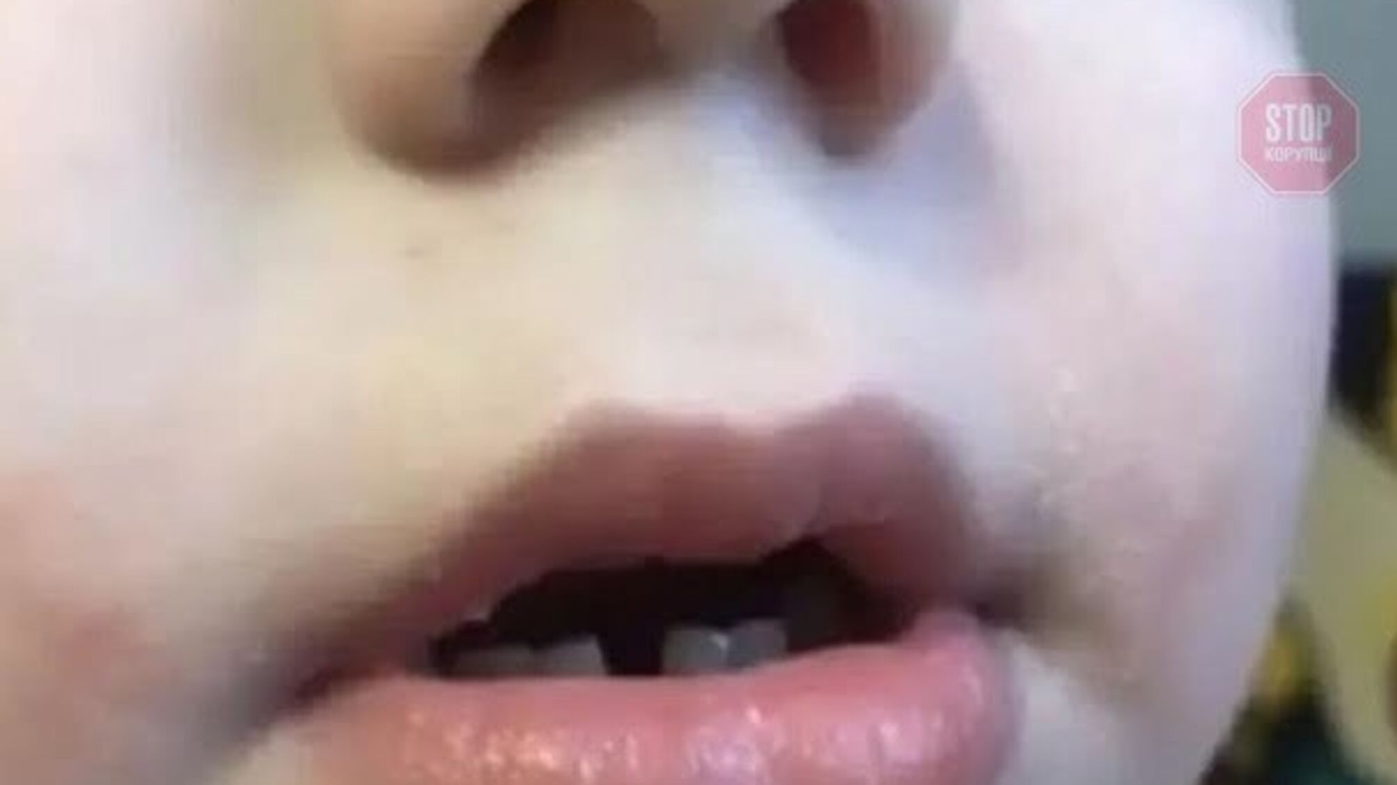 У Луцьку в дитсадку вихователь заклеїла дитині рот скотчем