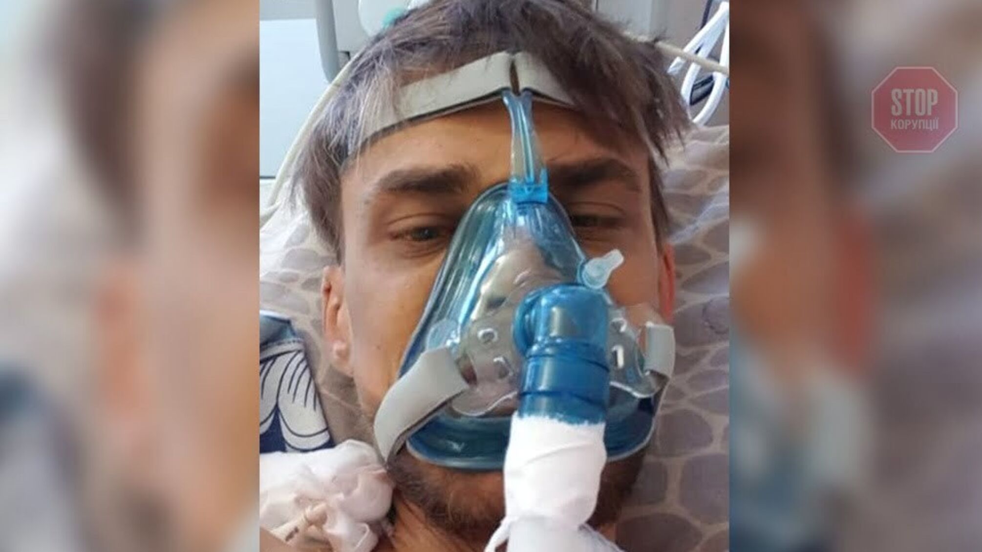 Осложнение после коронавирусной болезни убивает молодого украинца: ему нужна пересадка печени (фото)