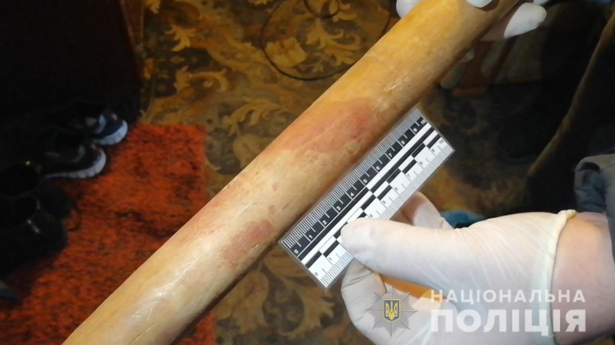 Поліцейські затримали 46-річного жителя Чорноморська за підозрою у спричиненні смертельних травм своїй співмешканці