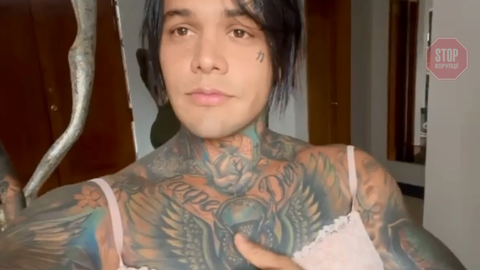 Колумбійський блогер встановив собі грудні імпланти через програш у парі (відео)