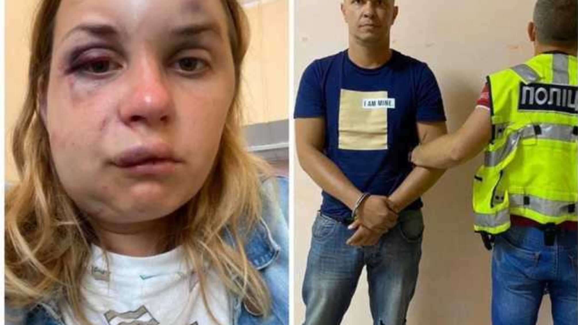 Стали відомі причини смерті чоловіка, який намагався у потягу зґвалтувати Анастасію Лугову