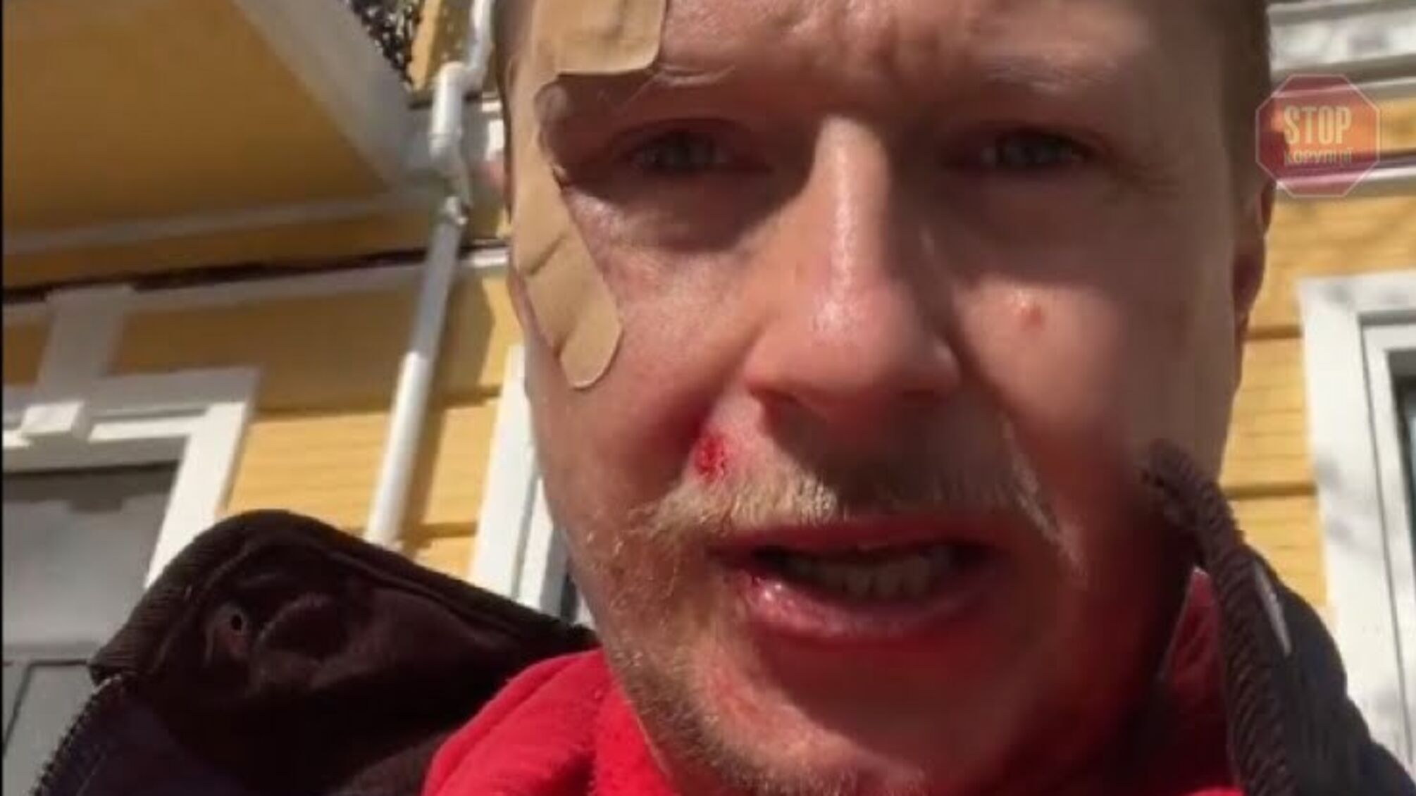 У столиці побили ведучого Майкла Щура (відео)