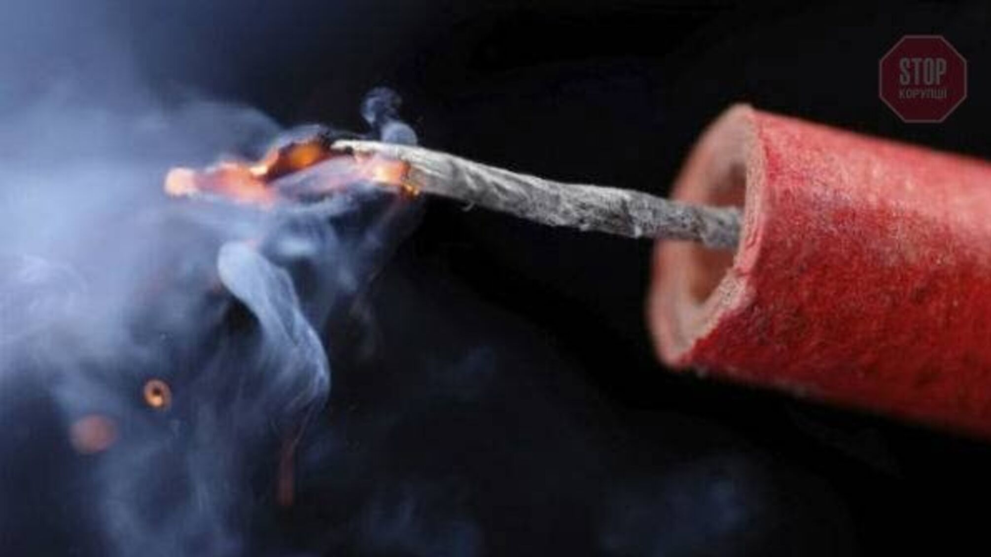 Відірвало палець: на Одещині під час уроку у 8-класника вибухнула петарда в руках