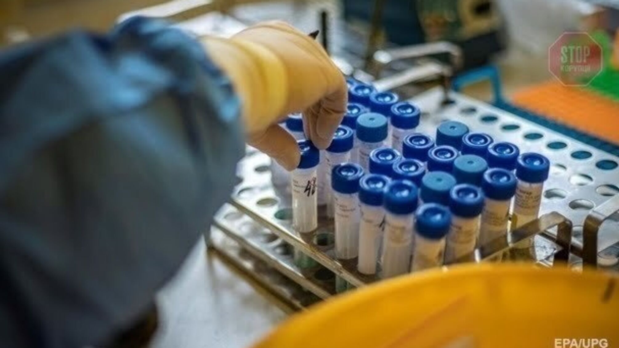Хотіла продати: у Києві співробітниця інституту біотехнологій вкрала небезпечні штами вірусів&nbsp;