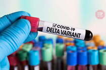 В Украине зафиксировали новые случаи коронавируса штамма ''Дельта''