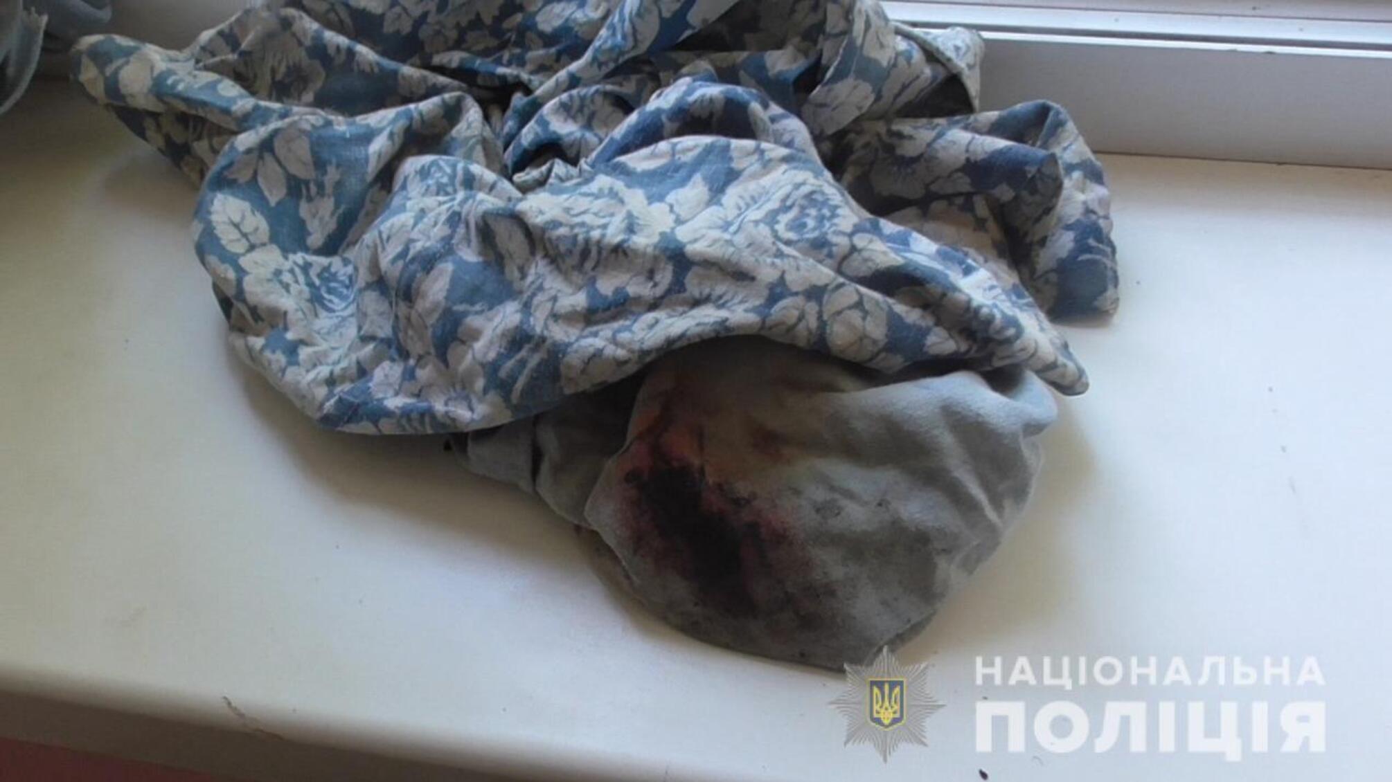 Поліцейські затримали двох чоловіків, які після знайомства з одеситом вчинили на нього розбійний напад