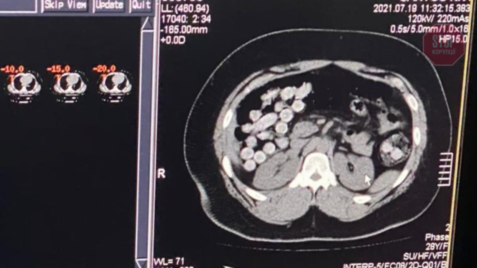 Проковтнув кілограм кокаїну: у 'Борисполі' затримали наркокур'єрів