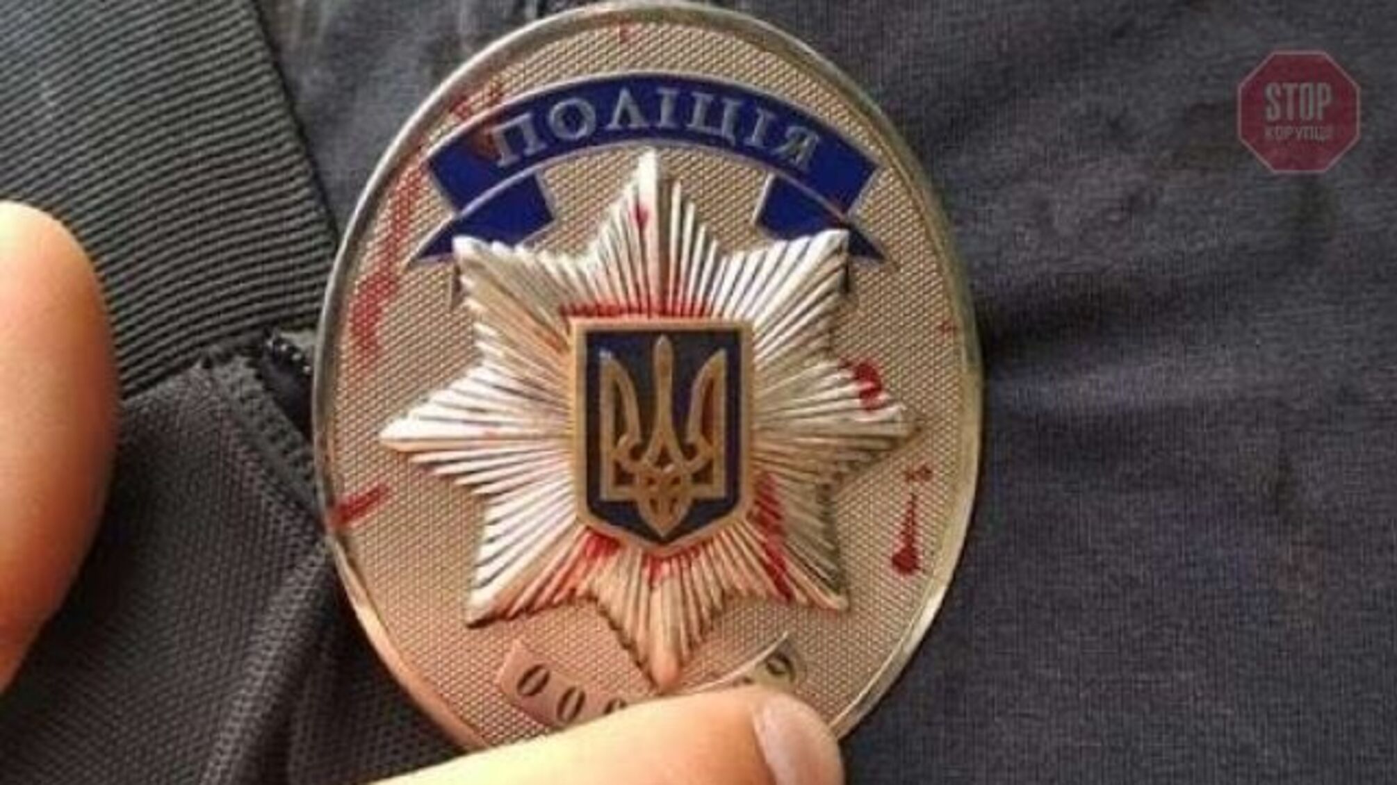 В Одесі чоловік побив поліцейського, бо той не забрав його сестру в ізолятор