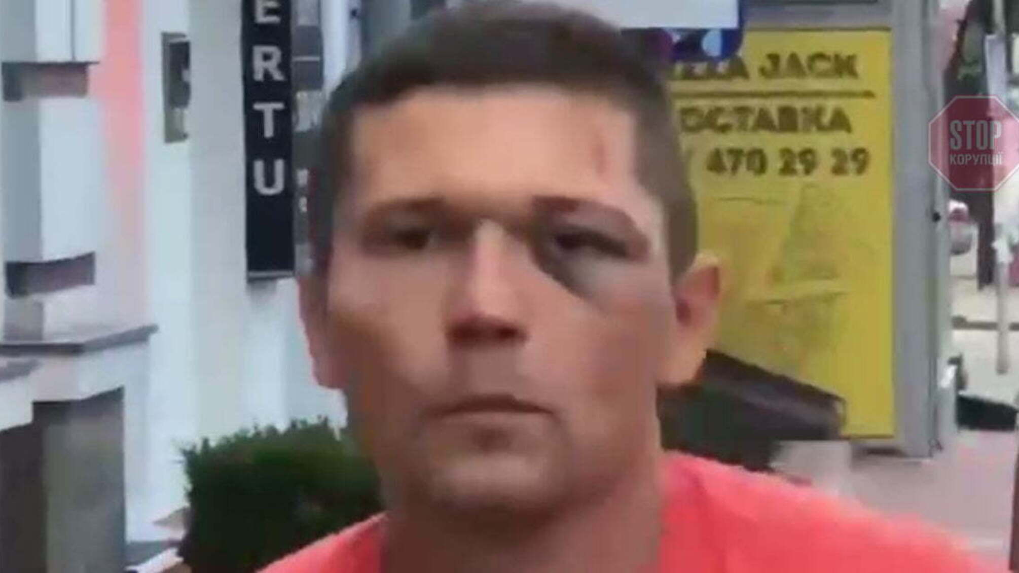 Бойца УГО, который жестоко избил танцовщика Дорофеевой, уволили