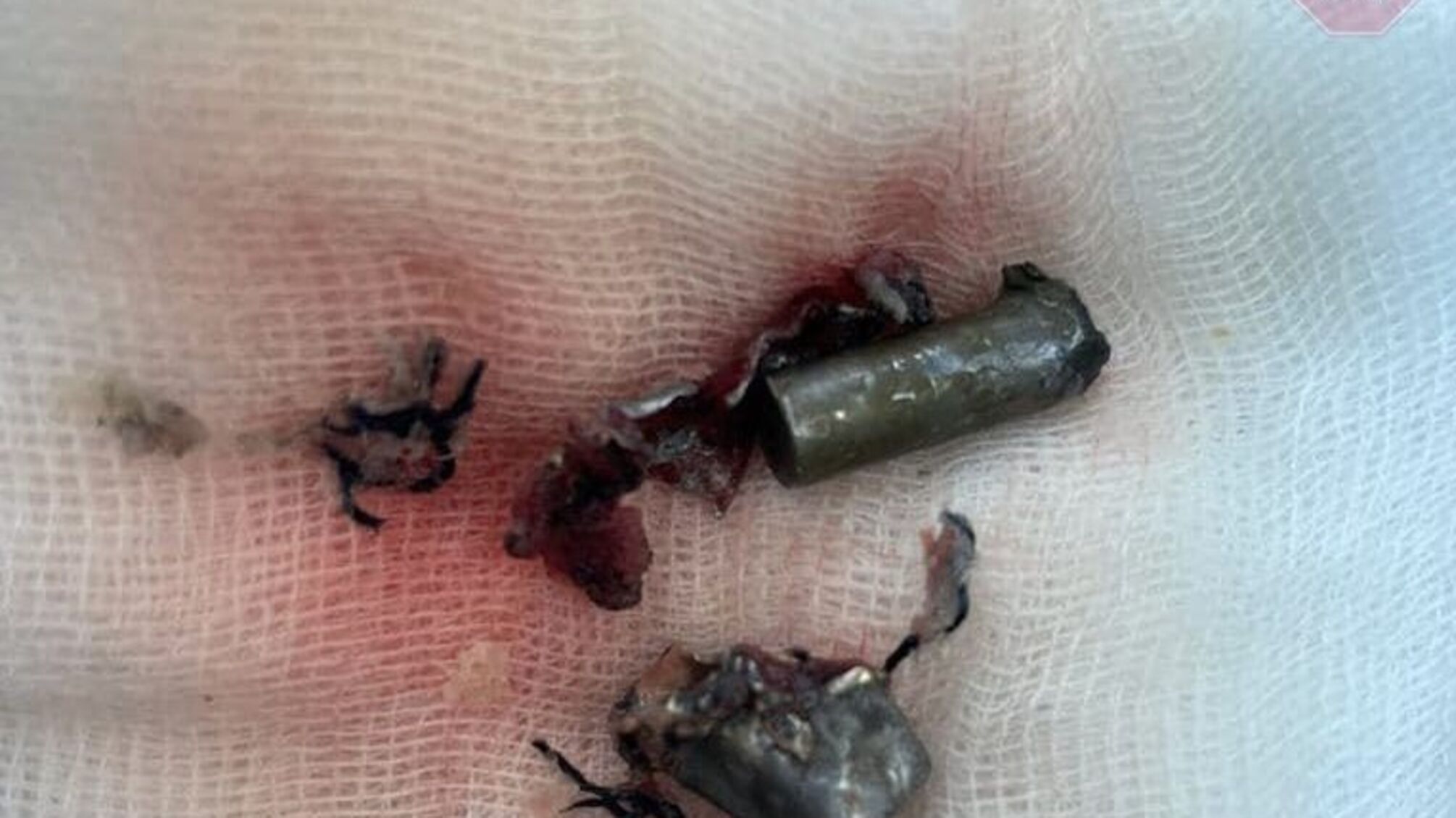 Замах на Шефіра: Монастирський показав кулі, що витягли з водія (фото)