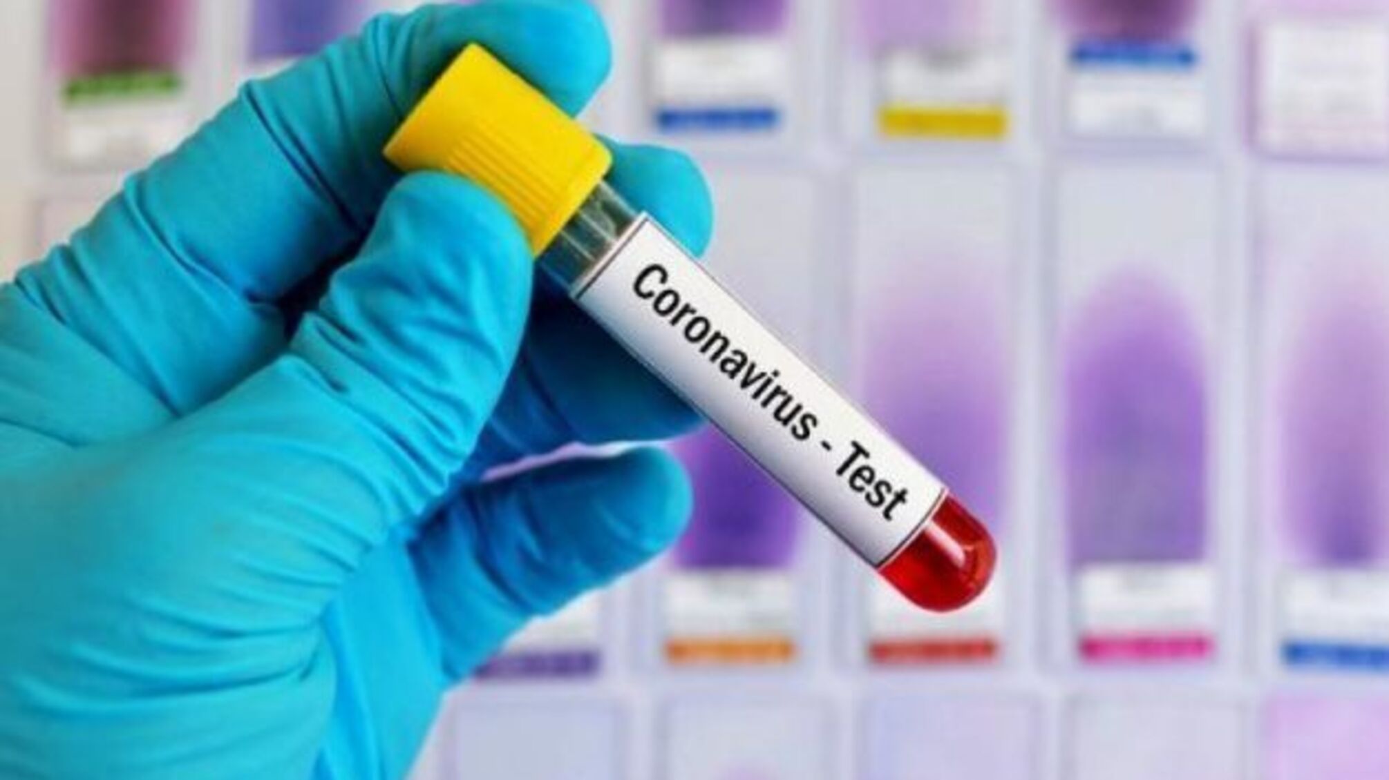 У Греції штрафуватимуть за фальшиві сертифікати вакцинації та COVID-тести