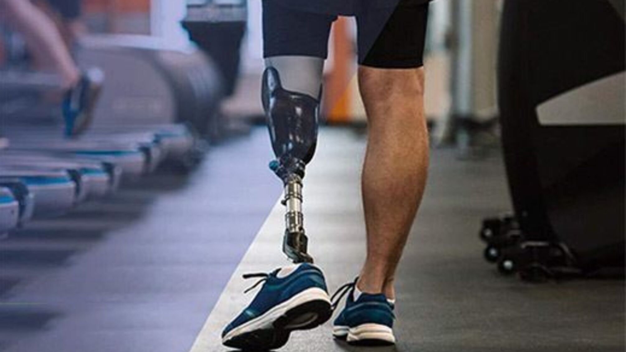 Німеччина допоможе Україні медиками і протезами