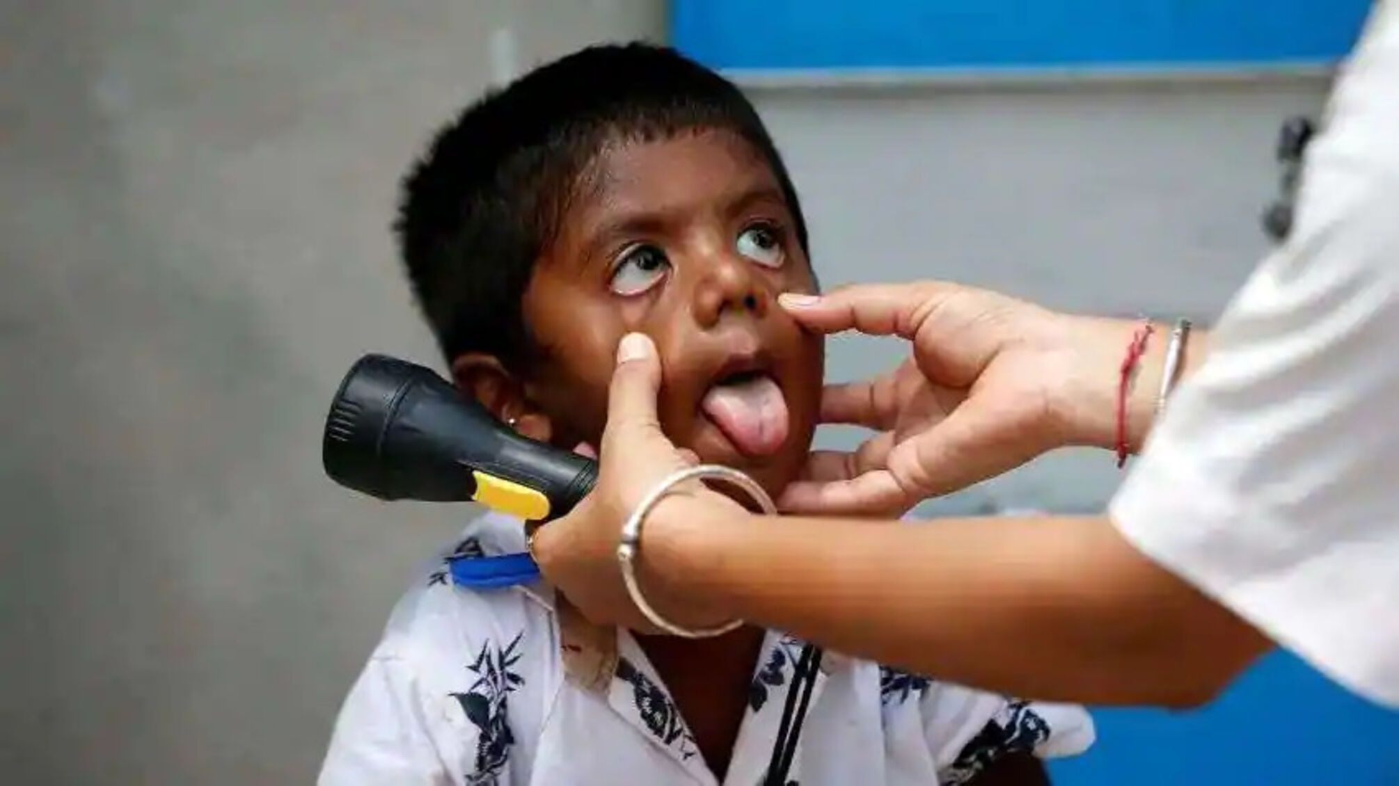 дитина язик Індія лікар
