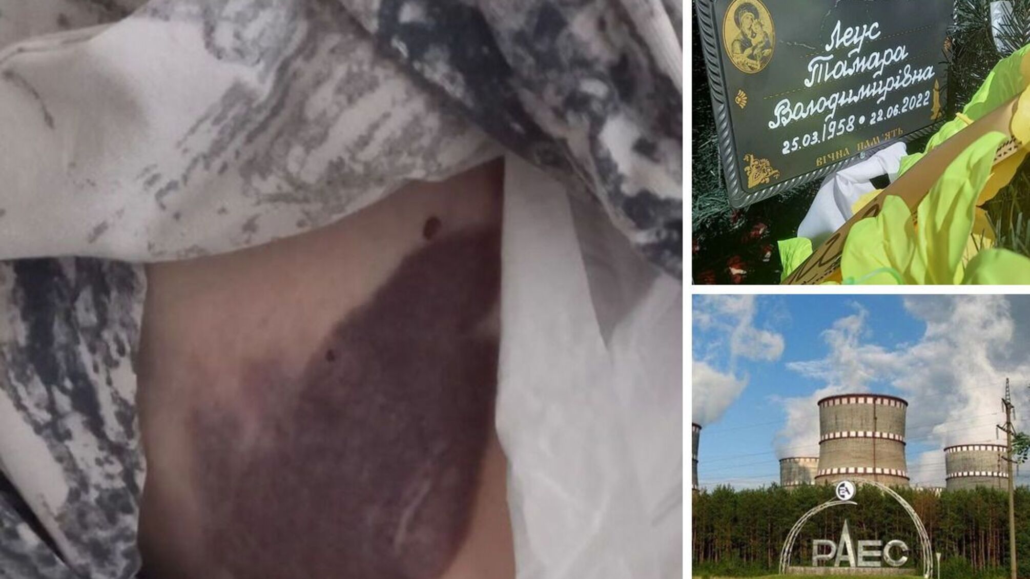 следует от избиения